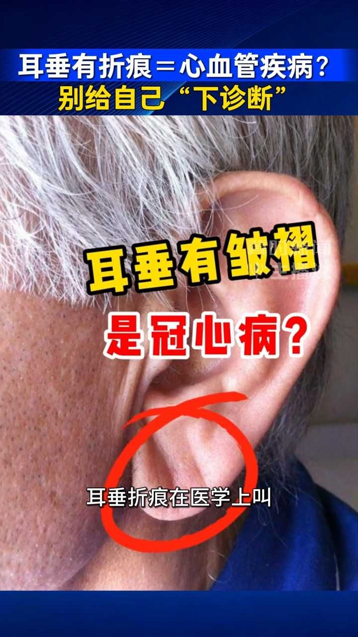 耳垂有折痕＝心血管疾病？别给自己“下诊断”｜冀时新闻主播说